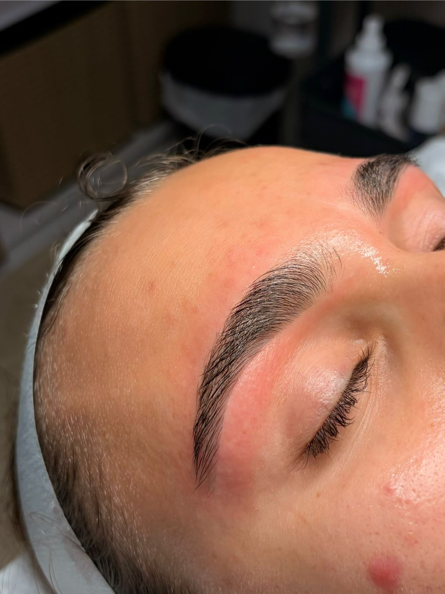 Skin treatment result