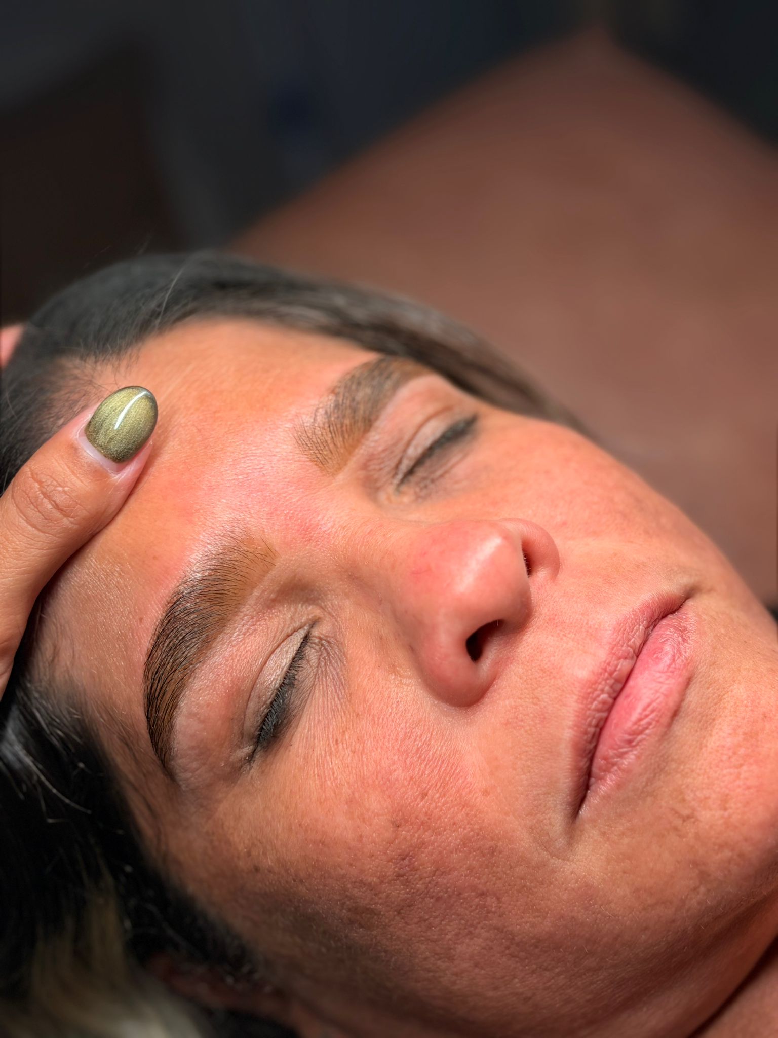 Brow and skin result